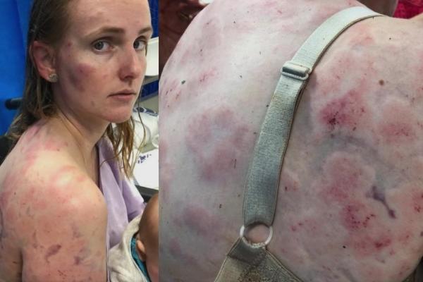 SVOJIM TELOM ZAŠTITILA BEBU OD POVREDA, PA ZAVRŠILA U BOLNICI: Da li je ovo najhrabrija MAJKA ikada?! (FOTO)