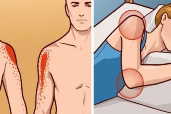 BOLI VAS LAKAT ILI RAME, A NISTE SE NIGDE UDARILI? Uradite samo jednu stvar i bol će zauvek nestati!