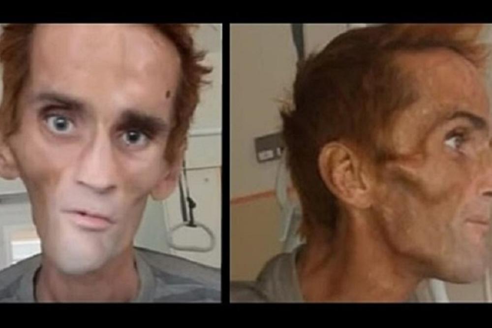 HRVATI GA TUKLI I ČUPALI MU ZUBE, DANIMA MOKRIO KRV: Ovaj Bosanac je bio njihov ROB, preživeo PAKAO! (VIDEO)