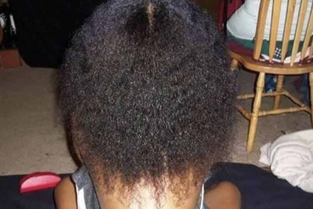 FOTOGRAFIJA DEVOJKE ZBUNILA CEO INTERNET: Nikome nije jasno u koji DEO TELA gleda! (FOTO)