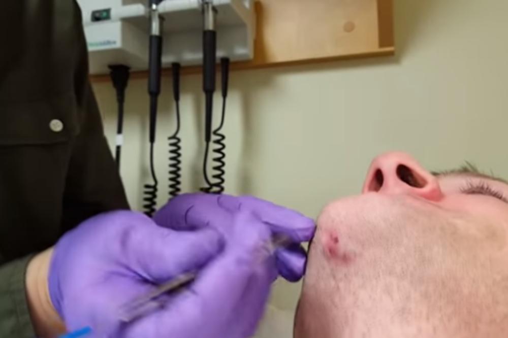 NA BRADI JE IMAO URASLU DLAKU: Kad su krenuli da mu je vade, ostali su u POTPUNOM ŠOKU! (VIDEO)