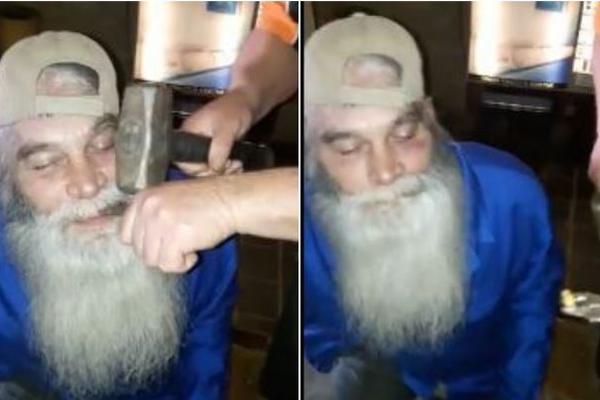 IZVADIO MU ZUB ČEKIĆEM I KLJEŠTIMA: Ovo nije za one sa slabim želucem! (VIDEO)
