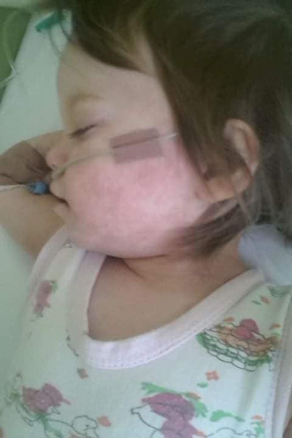 Mala Nađa nakon što se zarazila morbilama    