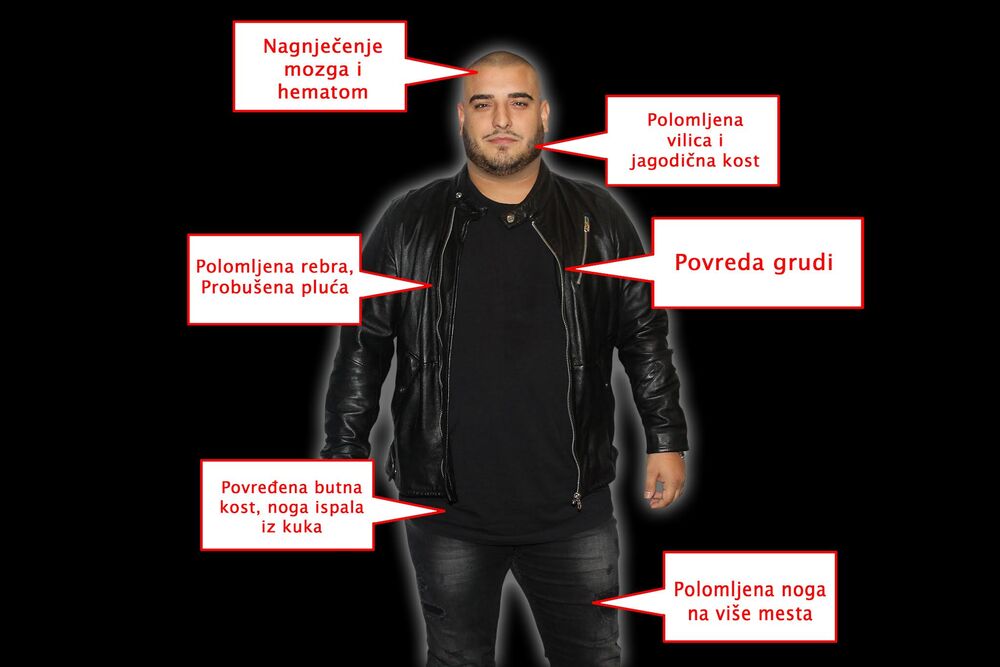 Povrede Darka Lazića