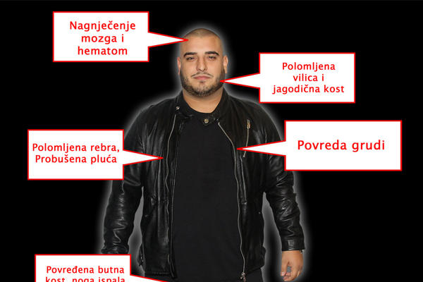 NAGNJEČENJE MOZGA, POLOMLJENA VILICA, PROBUŠENA PLUĆA: Šta je sve povredio Darko Lazić i koliko mu je život ugrožen