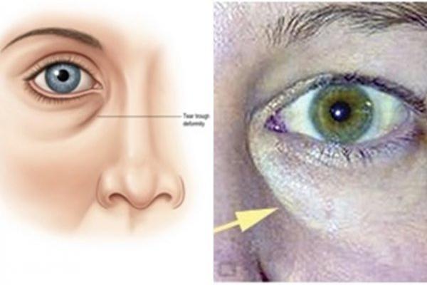 IMAMO REŠENJE ZA VAŠE PODOČNJAKE! Sve što treba da uradite je da otvorite frižider!