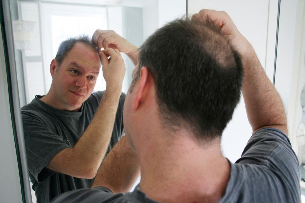 U OVO SREDSTVO SE SVI KUNU JER SPREČAVA OPADANJE KOSE: Muškarci ga stavljaju čak i na BRADU, morate ga nabaviti