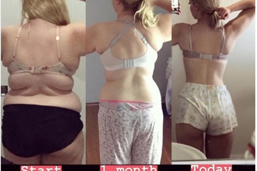 GADILA SE SAMOJ SEBI, A ONDA JE REŠILA DA TO PROMENI: Ova devojka je izgubla neverovatnih 60 kilograma! (FOTO)