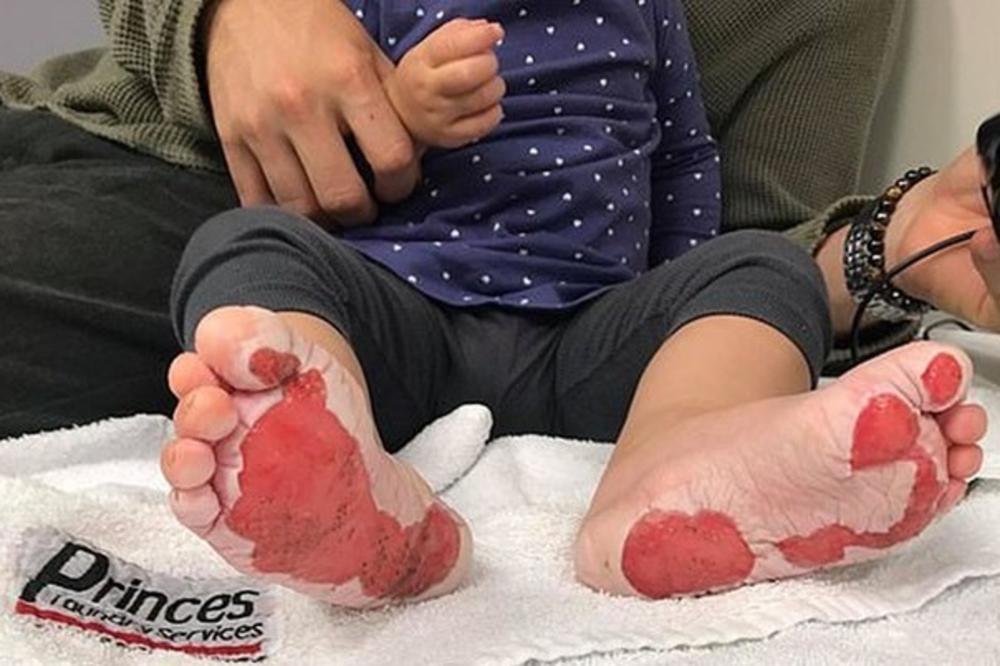 ČULA SAM SAMO UŽASNI KRIK! Njena ćerka je dobila opasne opekotine zbog nečega što se nalazi na SVAKOJ ULICI