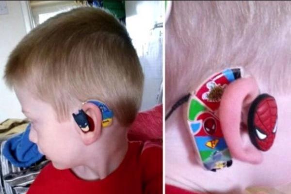 OVOG DEČAKA SU OSTALA DECA ISMEVALA: Njegova mama odlučila je da to PROMENI i sada svi žele ono što on ima! (VIDEO)