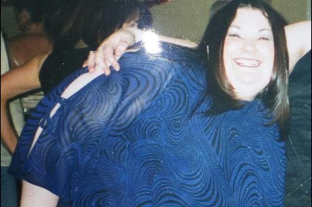 BILA JE MORBIDNO GOJAZNA: Izgubila je 111 kilograma, a nije uradila ni jedan jedini TRBUŠNJAK! (FOTO)