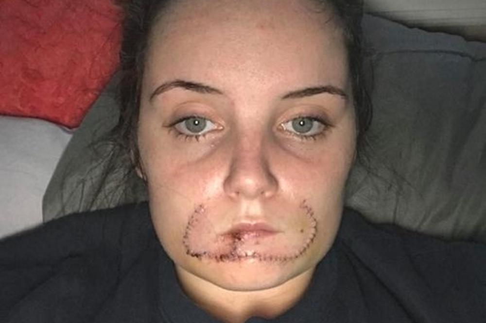 REKAO JE DA ĆE ME OZNAČITI ZA SLEDEĆEG DEČKA: Ova devojka je preživela najveći PAKAO! (FOTO)