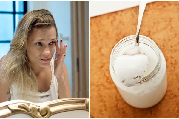 NIKAKVE SKUPE KREME I MASKE VAM NISU POTREBNE: Posle ove NAMIRNICE zaboravićete da ste ikada imali PODOČNJAKE!