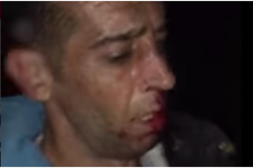 TVRDE DA SU IH PRETUKLI HRVATSKI POLICAJCI: Lomili su nam KOSTI NA GRANICI! OBJAVLJEN STRAVIČAN SMIMAK PREBIJANJA