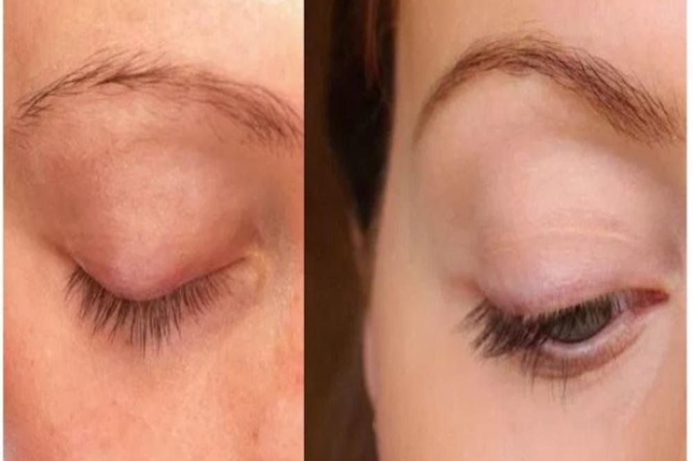 UZ POMOĆ OVOG TRIKA, VAŠE OBRVE ĆE UVEK IZGLEDATI SVETSKI: Žene otkrile genijalan trik, i JEDNOSTAVNO JE!