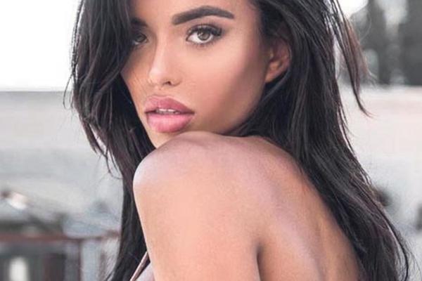 MISICA KOJA JE PREŽIVELA BOMBAŠKI NAPAD U ZEMUNU PRVI PUT POKAZALA OŽILJKE: Španska lepotica OBELEŽENA za ceo život