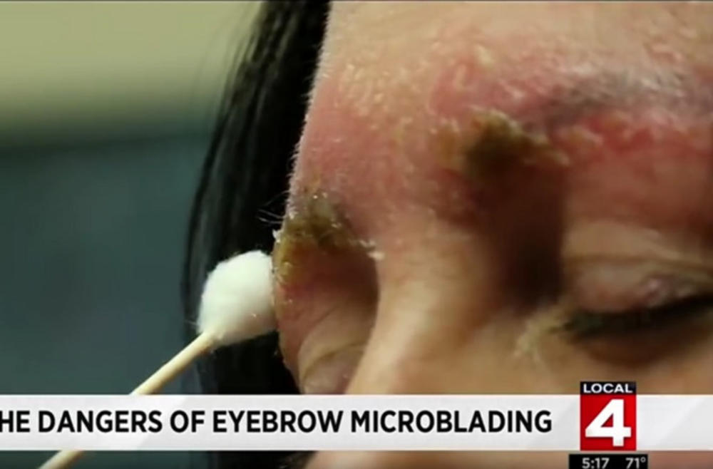 Preselo joj ulepšavanje  