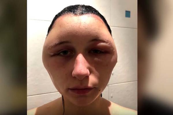 GLAVA MI JE BILA POPUT MEDUZE! Počela je da OTIČE nakon upotrebe preparata koji koristi većina žena! (VIDEO)