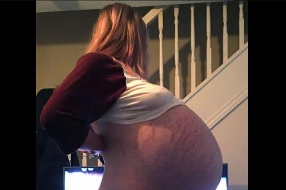 MISLILI SU DA JE U 9. MESECU TRUDNOĆE, ALI ULTRAZVUK JE OTKRIO HOROR: Svi lekari su ostali u šoku posle njega!