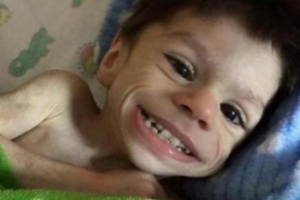 KADA GA JE USVOJILA IMAO JE 7 GODINA I 4 KILOGRAMA: Začudićete se kada vidite kako ovaj dečak danas izgleda! (FOTO)