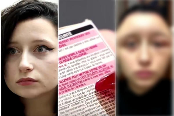 OFARBALA JE KOSU, PA SE UNIŠTILA: Ova hemikalija je u SVIM TAMNIM BOJAMA, a retko ko zna KOLIKO JE OPASNA