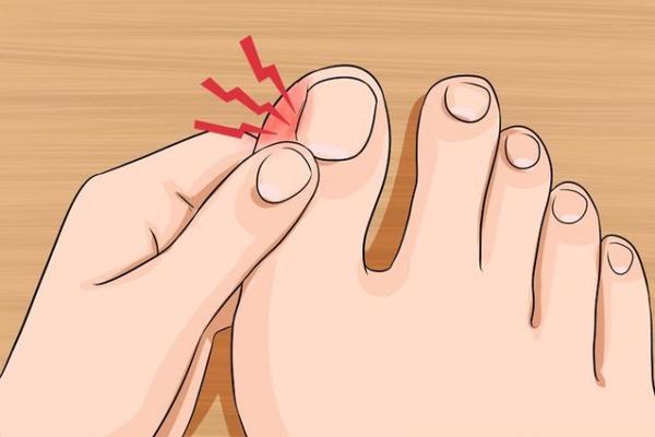 DUGO SE MUČILA SA URASLIM NOKTIMA DOK NIJE PRONAŠLA OVAJ LEK: Pogledajte šta joj je pomoglo! DELUJE NA KECA