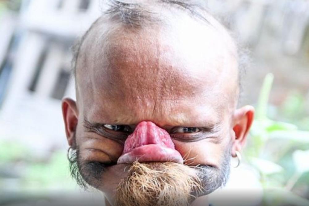 JEZIKOM MOŽE DA DOTAKNE ČELO I POLIŽE OBRVE: Deca ga se plaše, ali on ima velike PLANOVE! (VIDEO)