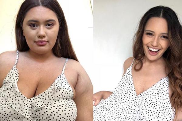 SMRŠALA JE 58 KILOGRAMA, DRUGI PUT: Transformacija ove devojke je NEVEROVATNA (FOTO)