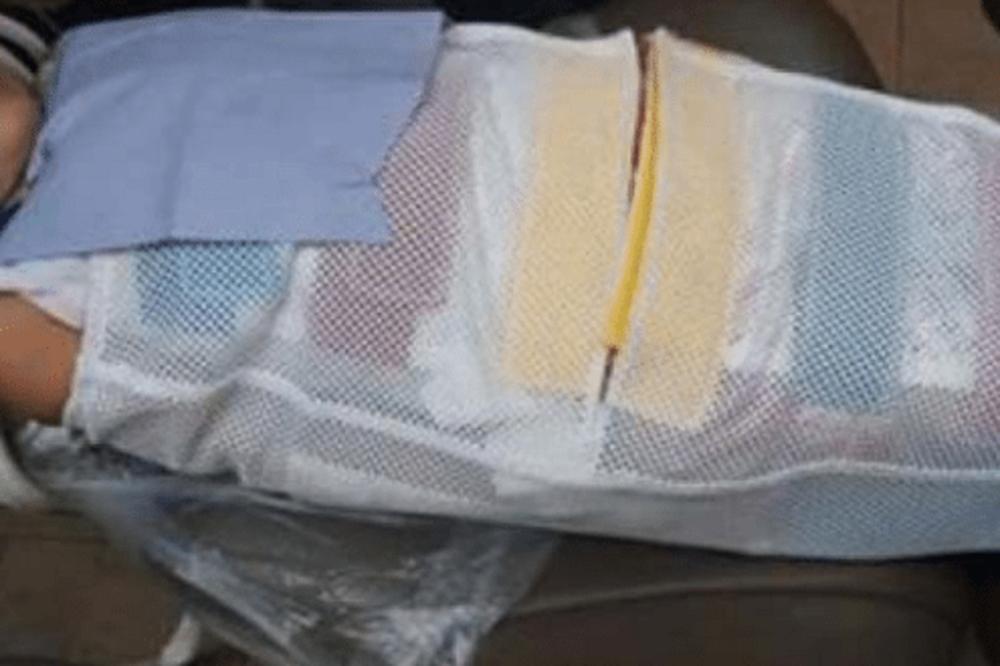 ODVELI SU ĆERKU KOD ZUBARA, A ONDA SU LEKARI URADILI NEŠTO NEHUMANO: Otac nije mogao ni da gleda šta joj rade!