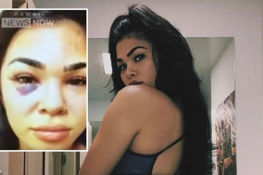 POJAVIO SE JEZIV SNIMAK SVIREPOG PREBIJANJA UFC LEPOTICE: Skočila je sa balkona da bi pobegla od muža nasilnika!