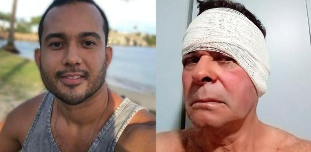 Ferera je ostao bez uva