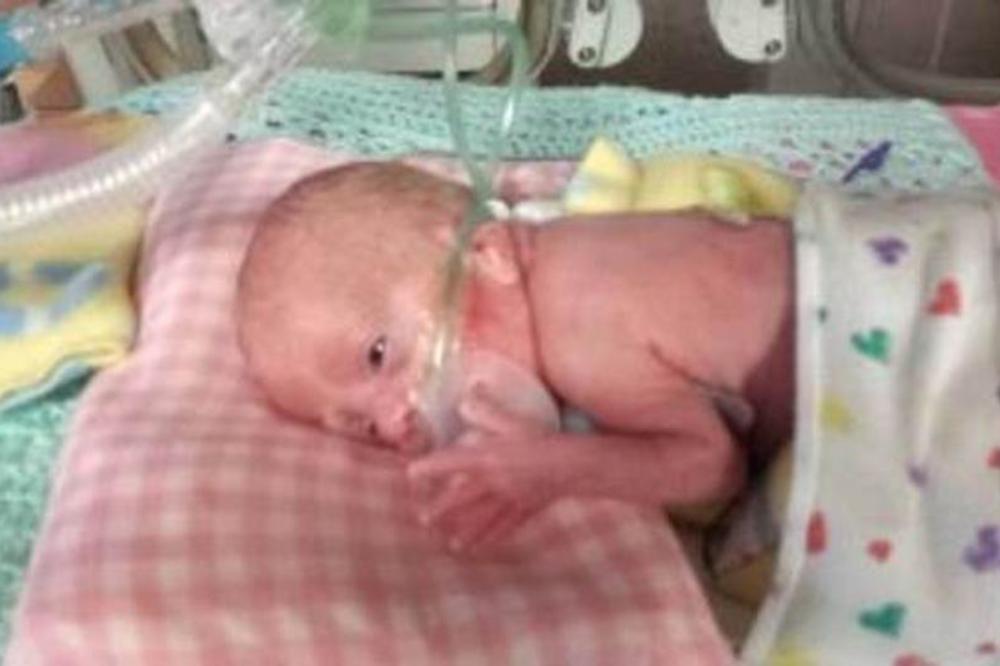 NA ROĐENJU JE IMALA 400 GRAMA: Beba se rodila 4 meseca pre vremena, danas je premašila očekivanja lekara! (FOTO)
