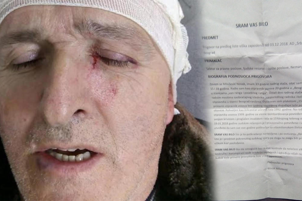 ISTEKAO MU UGOVOR PA GA PREBILI: Radnik dobio BATINE zbog JEDNOG PITANJA, a oglasila se i FIRMA! (FOTO)