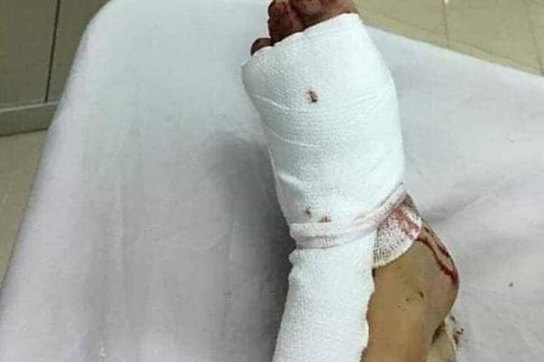 OBULA SEKSI ČARAPE DA ZAVEDE MUŽA, A ON JOJ POLOMIO NOGE PALICOM: Pre OSUDE, pogledajte ČARAPE! (FOTO)