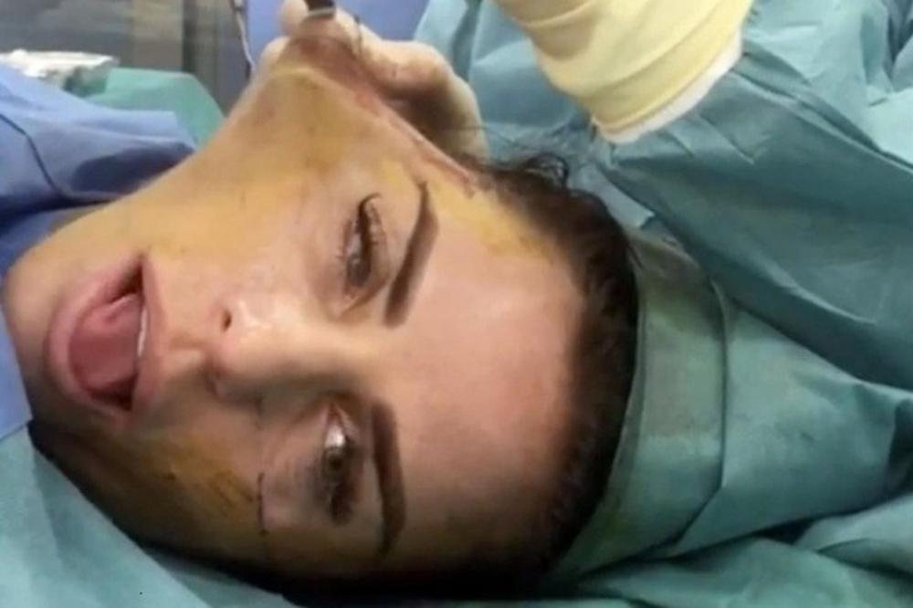 OVE FOTOGRAFIJE SU ZAISTA UZNEMIRUJUĆEG SADRŽAJA! Starleta objavila slike sa FEJSLIFTINGA! BOLESNO