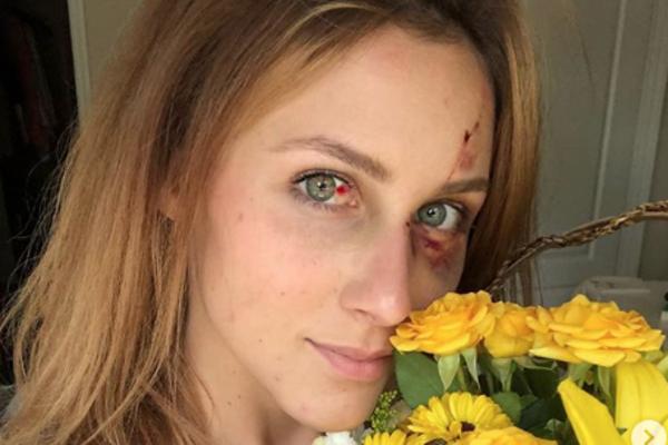 LJUBOMORNI DEČKO JE PRETUKAO: Ostavila ga i objavila fotografije koje joj je BRANIO da deli na društvenim mrežama!