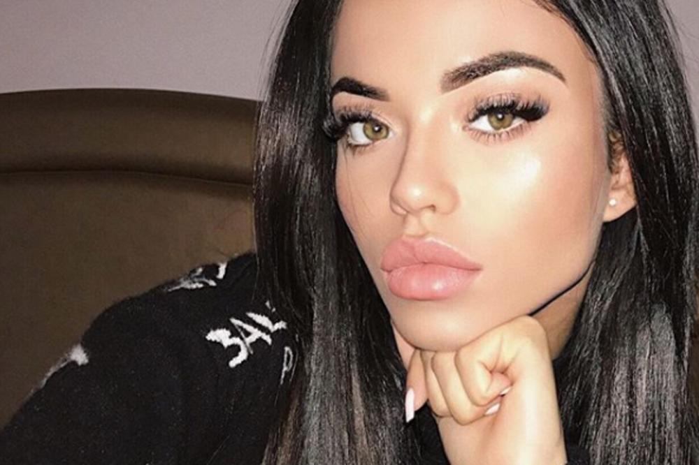 SEĆATE SE ŠPANSKE MISICE KOJA JE TEŠKO POVREĐENA u eksploziji u Beogradu? Poslala je EMOTIVNU PORUKU doktoru sa VMA