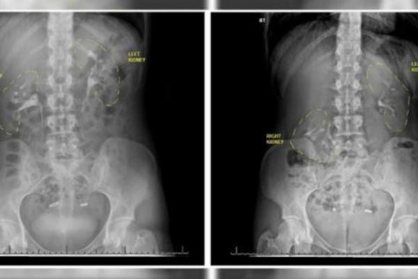 GODINAMA SE ŽALILA DA NEŠTO MRDA U NJOJ, A LEKARI JOJ NISU VEROVALI: Tek kada je zatrudnela su joj otkrili BOLEST!