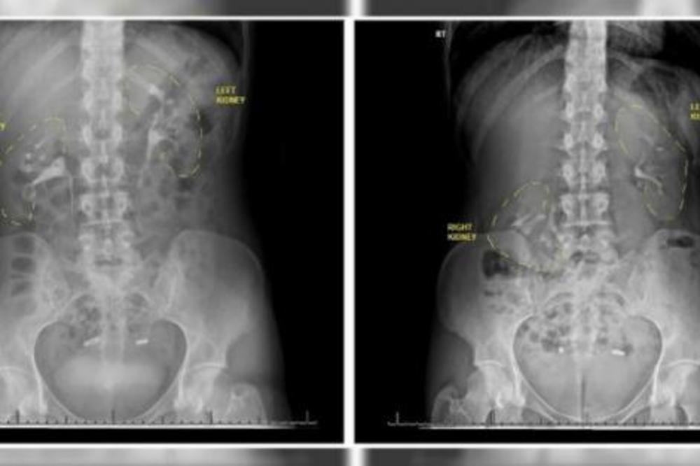 GODINAMA SE ŽALILA DA NEŠTO MRDA U NJOJ, A LEKARI JOJ NISU VEROVALI: Tek kada je zatrudnela su joj otkrili BOLEST!