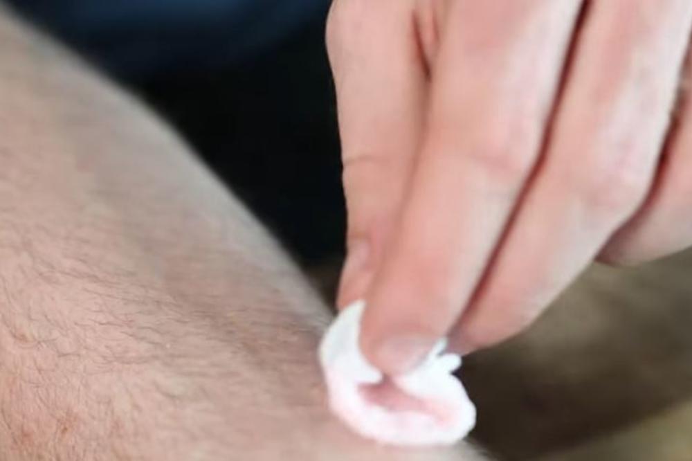 SVAKE NOĆI PRE SPAVANJA STAVILA JE MALO OVE SMESE NA STARAČKE PEGE: Za 7 dana iznenadila se rezultatom