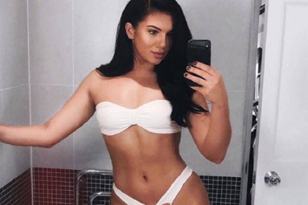 UNIŠTIO JE TRETMAN LICA KOJI JE PAPRENO PLATILA: Aleksandrino LICE sada izgleda SPRŽENO (UZNEMIRUJUĆE FOTOGRAFIJE)