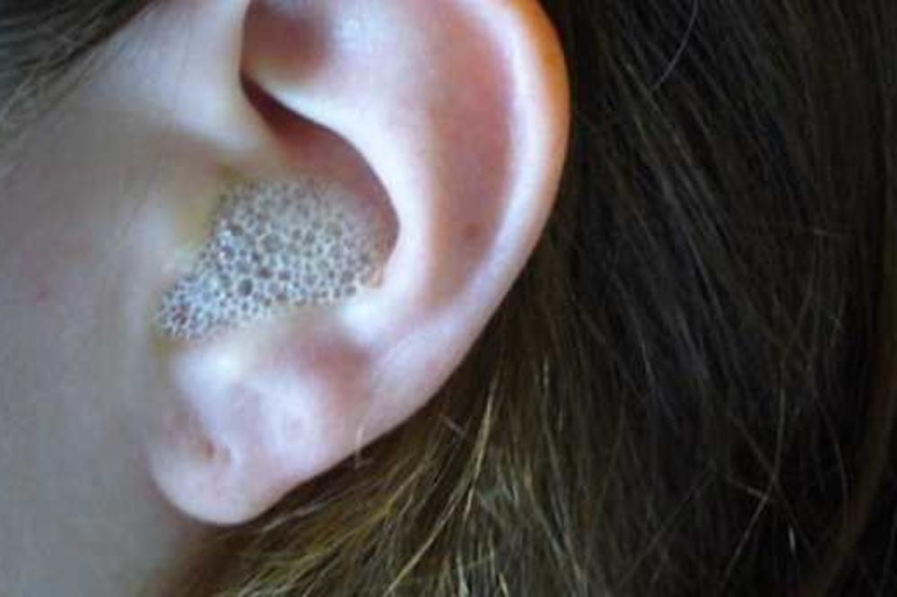 SVA PRLJAVŠTINA ĆE ODMAH IZAĆI: Evo kako da ODMAH ISPERETE UŠI!