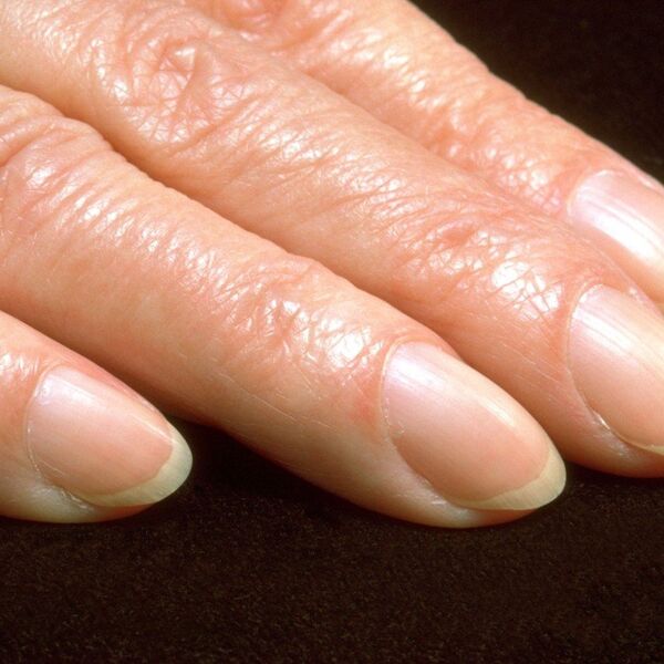 Mislite da je beli polumesec na noktima beznačajan? Pogledajte malo bolje - stručnjaci otkrivaju šta on znači