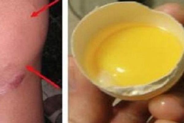 NE, JAJA I SO NE LEČE BOL U KOLENIMA