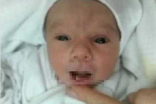 U SRPSKOM PRIZRENU RODILA SE BEBA FENOMEN! Lekari nisu verovali šta vide kad su joj otvorili usta! (FOTO)