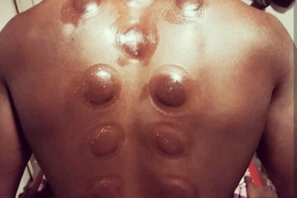 NIKADA NEĆETE POGODITI ČIJA SU OVO LEĐA: Pomoći ćemo vam - igra za Partizan, u njega se polaže mnogo nade!