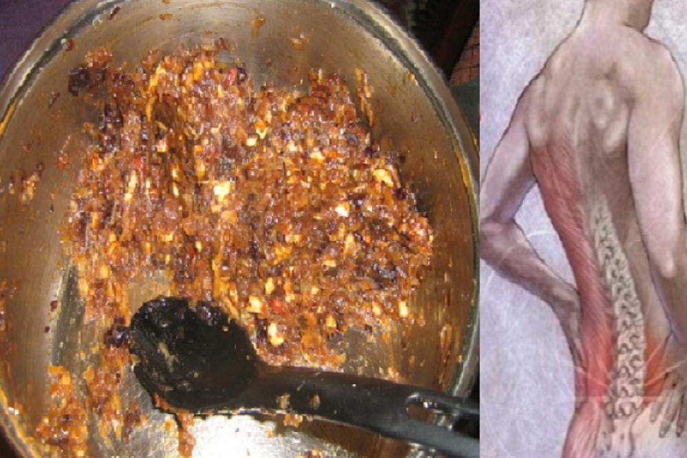 NARODNI LEK ZA POTPUNI OPORAVAK KIČME I ZGLOBOVA: Pršljenovi počinju sami da se pomeraju, OVO JE ČUDO! (RECEPT)