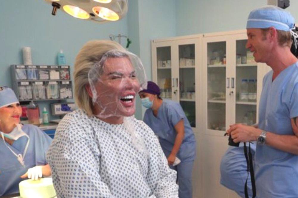 JEZIVO! RIJALITI ZVEZDA PONOVO ŠOKIRAO SVET: Nakon 70. OPERCIJE ne liči na LJUDSKO BIĆE! (FOTO)