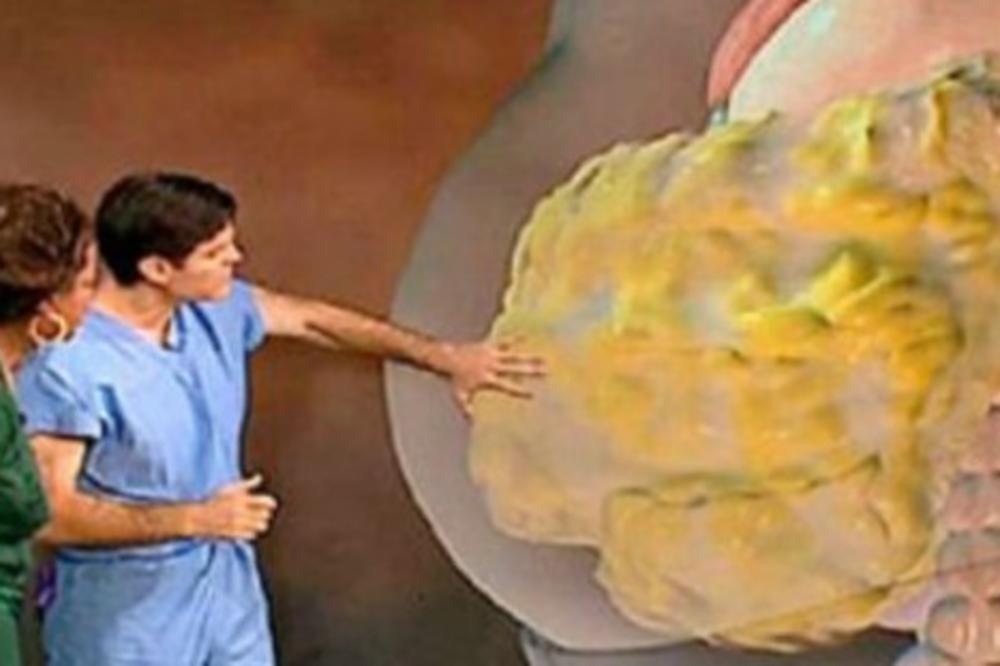 ČAJ ZA MRŠAVLJENJE OD TRI SASTOJKA IZAZVAO GLOBALNO LUDILO: Rezultati su vidljivi već  nakon 24 sata! (RECEPT)