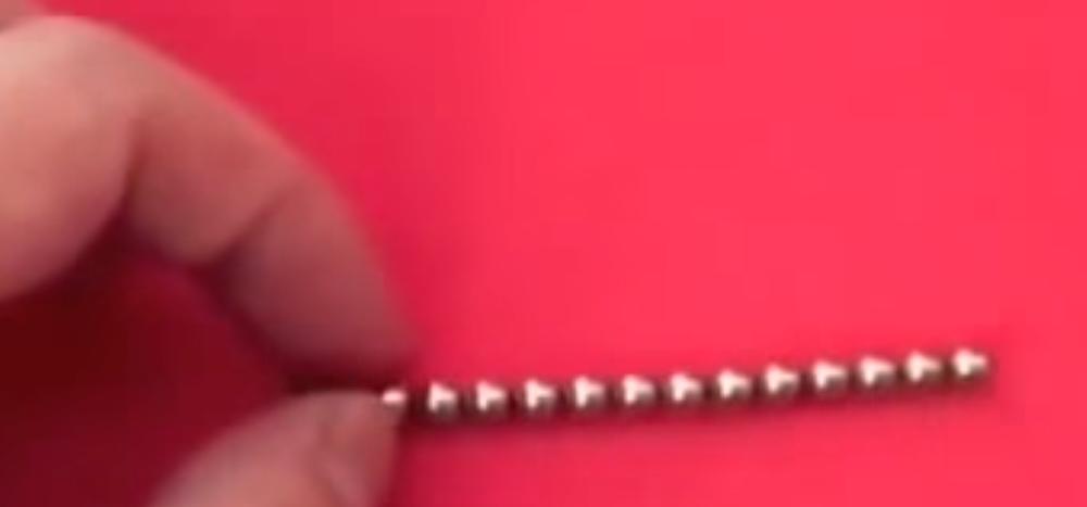 Ovako izgledaju magneti sa kojima se dečak 'igrao'